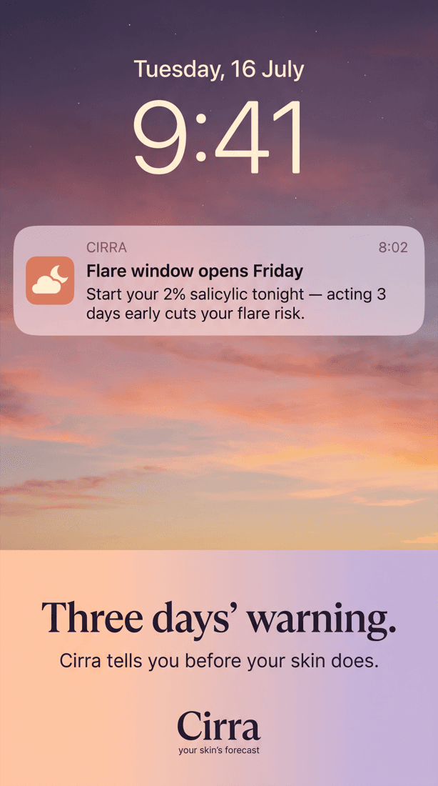 A phone lock screen showing a Cirra notification that a flare window is opening.