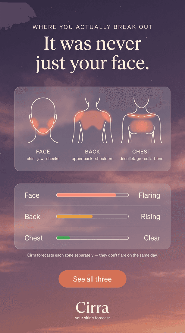 Diagram of face, back and chest zones, each with its own forecast status.